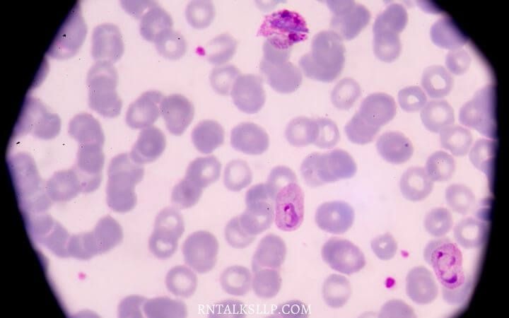 Malaria Quiz Test Your Malaria Prevention Knowledge